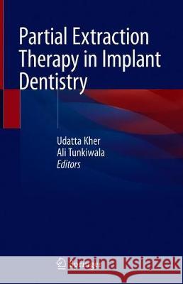 Partial Extraction Therapy in Implant Dentistry Udatta Kher Ali Tunkiwala 9783030336097 Springer