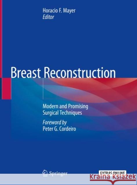 Breast Reconstruction: Modern and Promising Surgical Techniques Mayer, Horacio F. 9783030346027 Springer