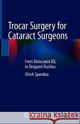 Trocar Surgery for Cataract Surgeons: From Dislocated Iol to Dropped Nucleus Spandau, Ulrich 9783030360924