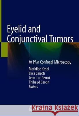 Eyelid and Conjunctival Tumors: In Vivo Confocal Microscopy Kaspi, Mathilde 9783030366056 Springer