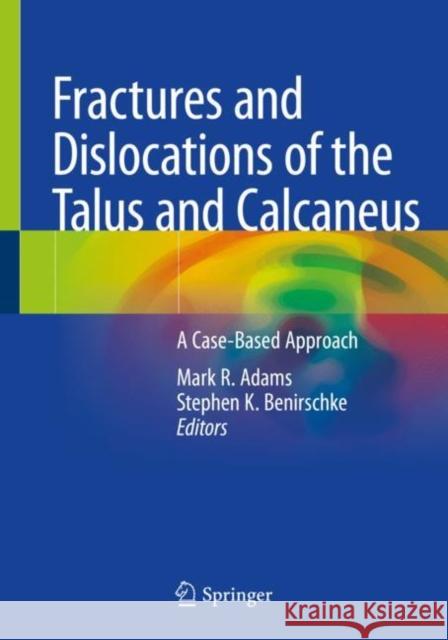 Fractures and Dislocations of the Talus and Calcaneus: A Case-Based Approach Mark R. Adams Stephen K. Benirschke 9783030373658