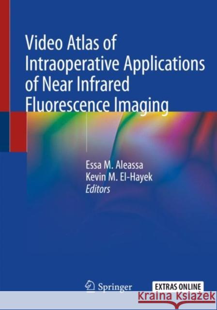 Video Atlas of Intraoperative Applications of Near Infrared Fluorescence Imaging Essa M. Aleassa Kevin M. El-Hayek 9783030380946 Springer