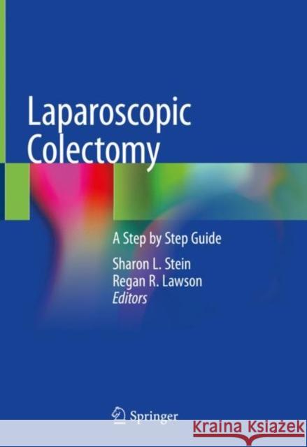 Laparoscopic Colectomy: A Step by Step Guide Stein, Sharon L. 9783030395575 Springer