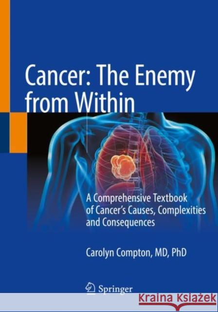 Cancer: The Enemy from Within: A Comprehensive Textbook of Cancer's Causes, Complexities and Consequences Carolyn Compton 9783030406530 Springer
