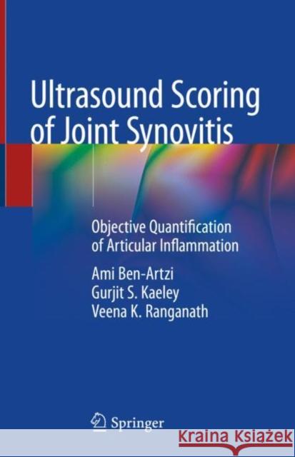 Ultrasound Scoring of Joint Synovitis: Objective Quantification of Articular Inflammation Ben-Artzi, Ami 9783030432713 Springer