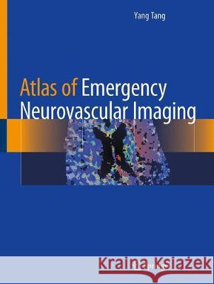 Atlas of Emergency Neurovascular Imaging Yang Tang 9783030436537 Springer