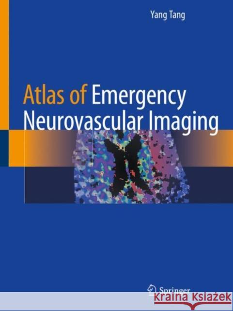 Atlas of Emergency Neurovascular Imaging Yang Tang 9783030436568 Springer