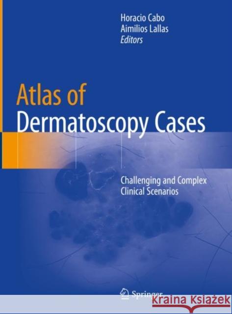 Atlas of Dermatoscopy Cases: Challenging and Complex Clinical Scenarios Cabo, Horacio 9783030436711
