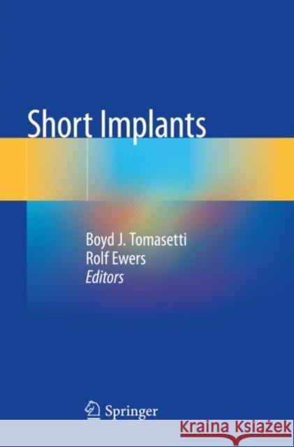 Short Implants Boyd J. Tomasetti Rolf Ewers 9783030442019 Springer