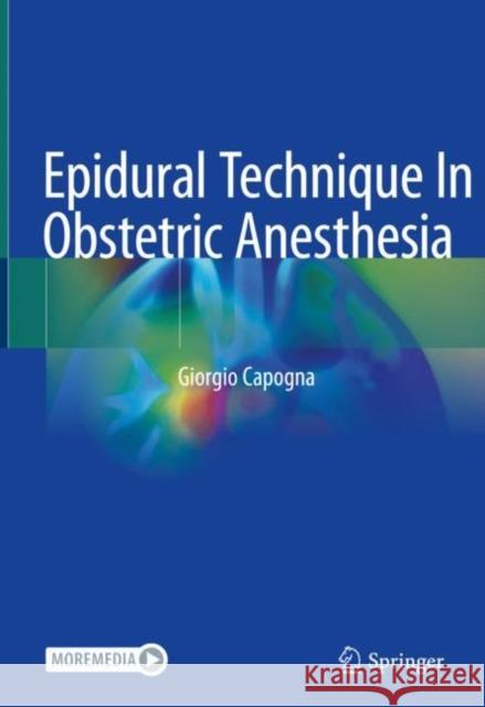 Epidural Technique in Obstetric Anesthesia Capogna, Giorgio 9783030453312 Springer