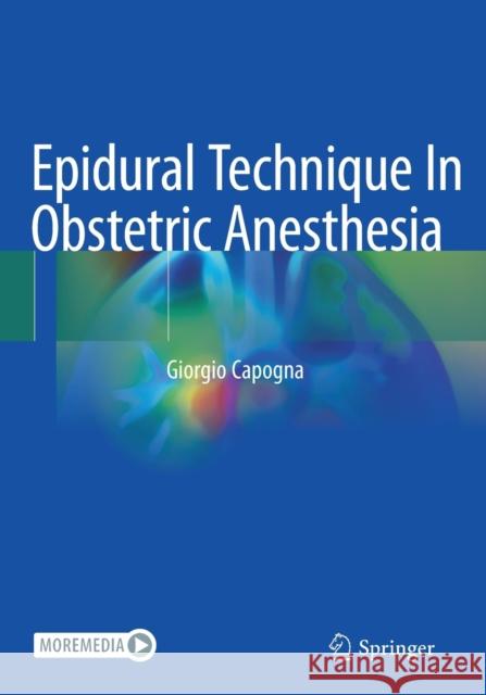 Epidural Technique in Obstetric Anesthesia Giorgio Capogna 9783030453343 Springer