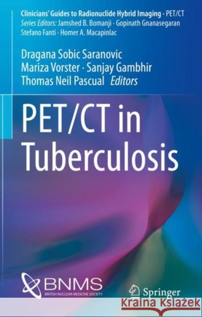 Pet/CT in Tuberculosis Sobic Saranovic, Dragana 9783030470081 Springer