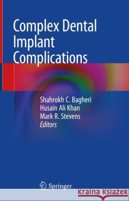Complex Dental Implant Complications Shahrokh Bagheri Husain Ali Khan Mark R. Stevens 9783030470111 Springer