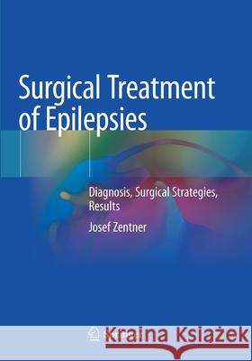 Surgical Treatment of Epilepsies: Diagnosis, Surgical Strategies, Results Josef Zentner 9783030487508 Springer