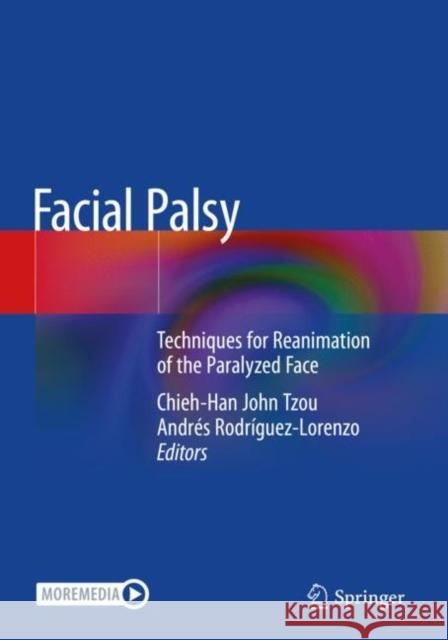 Facial Palsy  9783030507862 Springer International Publishing