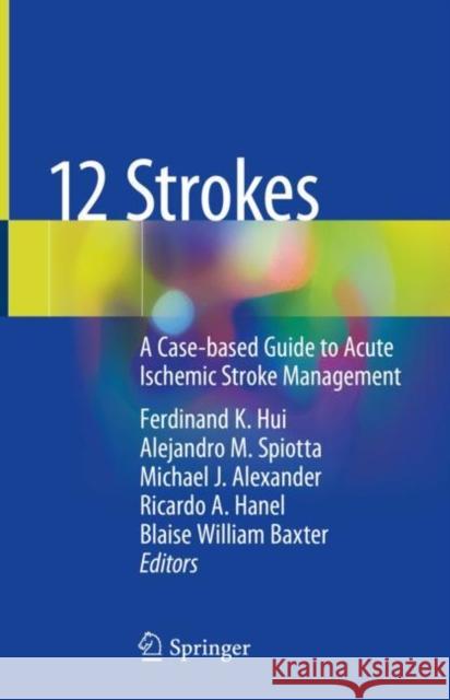 12 Strokes: A Case-Based Guide to Acute Ischemic Stroke Management Ferdinand K. Hui Alejandro M. Spiotta Michael J. Alexander 9783030568566 Springer