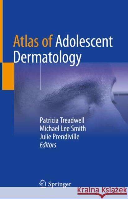 Atlas of Adolescent Dermatology Patricia Treadwell Michael Lee Smith Julie Prendiville 9783030586331