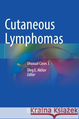 Cutaneous Lymphomas: Unusual Cases 3 Oleg E. Akilov 9783030591281 Springer