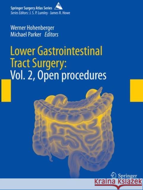 Lower Gastrointestinal Tract Surgery: Vol. 2, Open Procedures Hohenberger, Werner 9783030608293