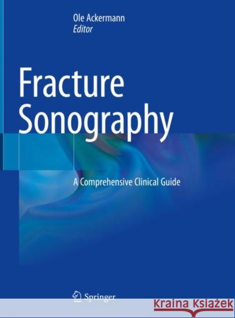Fracture Sonography: A Comprehensive Clinical Guide Ole Ackermann 9783030638382 Springer