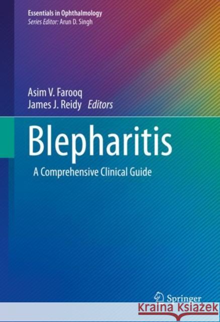 Blepharitis: A Comprehensive Clinical Guide Asim V. Farooq James J. Reidy 9783030650391 Springer
