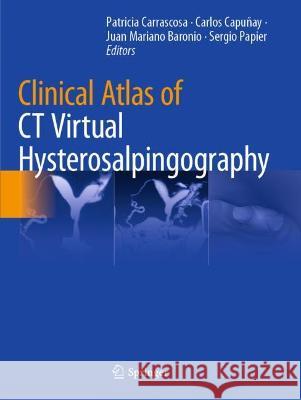 Clinical Atlas of CT Virtual Hysterosalpingography  9783030662097 Springer International Publishing