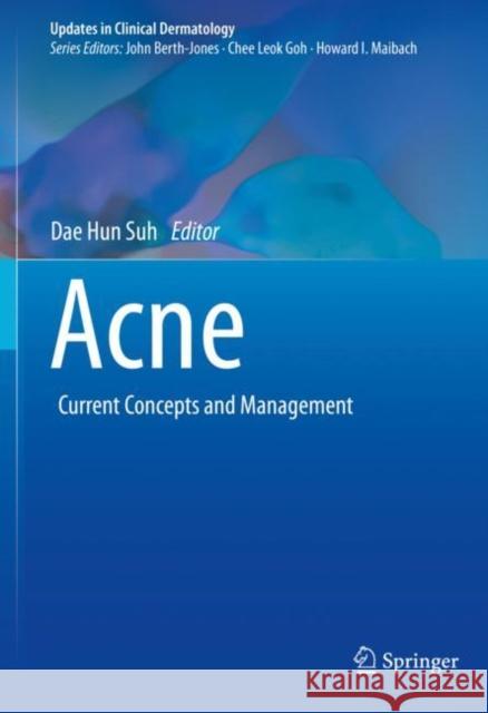Acne: Current Concepts and Management Dae Hun Suh 9783030689957 Springer