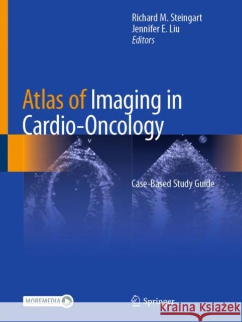 Atlas of Imaging in Cardio-Oncology: Case-Based Study Guide Richard M. Steingart Jennifer Liu 9783030709976 Springer