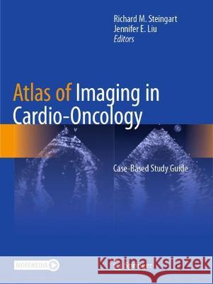 Atlas of Imaging in Cardio-Oncology: Case-Based Study Guide Steingart, Richard M. 9783030710002 Springer International Publishing