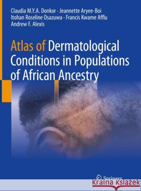 Atlas of Dermatological Conditions in Populations of African Ancestry Claudia M. Y. a. Donkor Jeannette Aryee-Boi Itohan Roseline Osazuwa 9783030726164 Springer
