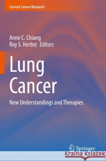 Lung Cancer: New Understandings and Therapies Chiang, Anne C. 9783030740306