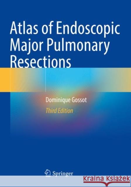Atlas of Endoscopic Major Pulmonary Resections Dominique Gossot 9783030741174 Springer International Publishing