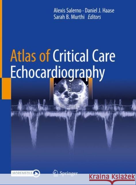 Atlas of Critical Care Echocardiography Alexis Salerno Daniel Haase Sarah B. Murthi 9783030746858 Springer