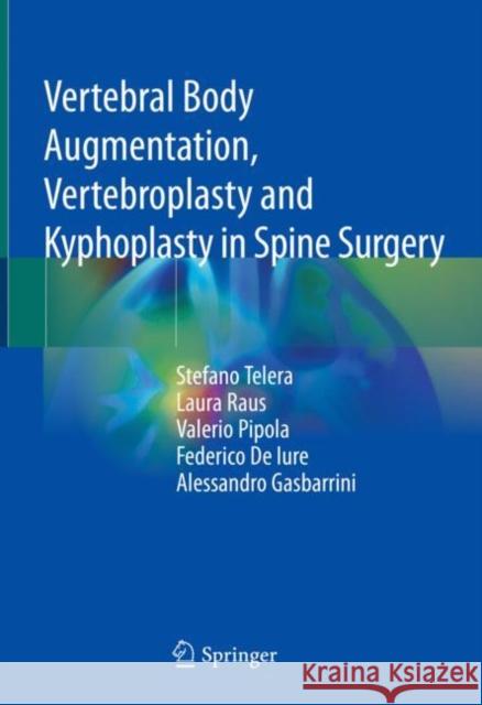 Vertebral Body Augmentation, Vertebroplasty and Kyphoplasty in Spine Surgery Stefano Telera Laura Raus Valerio Pipola 9783030765545