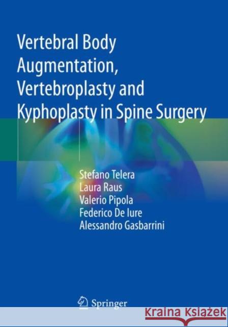 Vertebral Body Augmentation, Vertebroplasty and Kyphoplasty in Spine Surgery Stefano Telera, Laura Raus, Valerio Pipola 9783030765576 Springer International Publishing