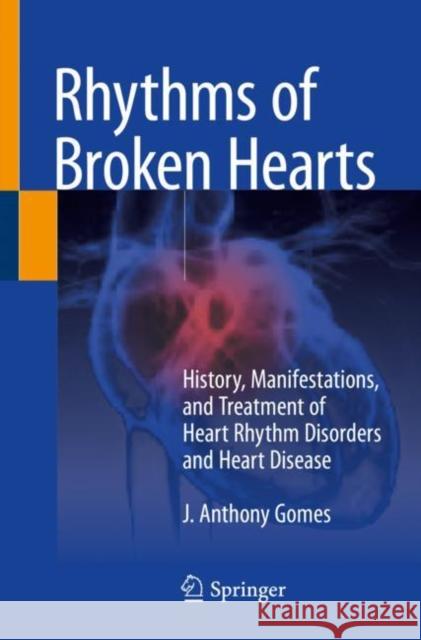 Rhythms of Broken Hearts: History, Manifestations, and Treatment of Heart Rhythm Disorders and Heart Disease J. Anthony Gomes 9783030773816 Springer