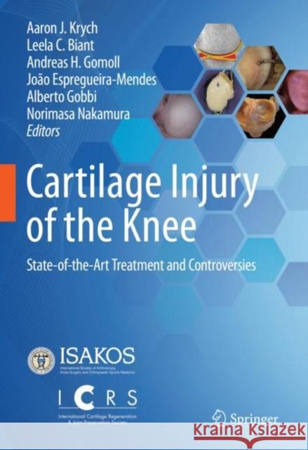 Cartilage Injury of the Knee: State-Of-The-Art Treatment and Controversies Aaron J. Krych Leela C. Biant Andreas Gomoll 9783030780500 Springer