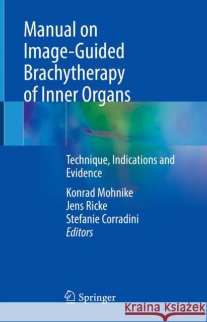 Manual on Image-Guided Brachytherapy of Inner Organs: Technique, Indications and Evidence Konrad Mohnike Jens Ricke Stefanie Corradini 9783030780784 Springer