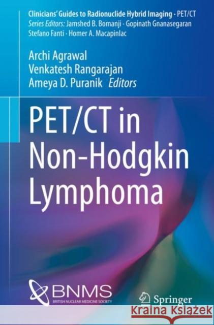 Pet/CT in Non-Hodgkin Lymphoma Archi Agrawal Venkatesh Rangarajan Ameya Puranik 9783030790066 Springer