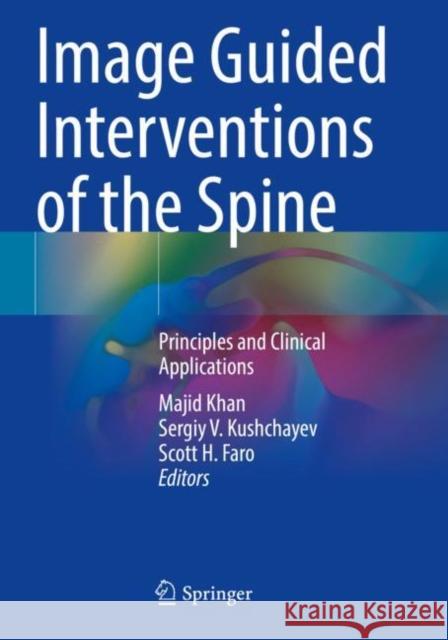 Image Guided Interventions of the Spine: Principles and Clinical Applications Khan, Majid 9783030800819