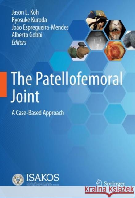 The Patellofemoral Joint: A Case-Based Approach Jason L. Koh Ryosuke Kuroda Jo 9783030815448 Springer