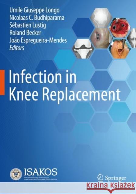 Infection in Knee Replacement Umile Giuseppe Longo Nicolaas C. Budhiparama S?bastien Lustig 9783030815554 Springer