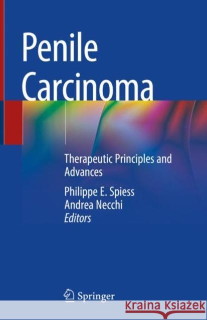 Penile Carcinoma: Therapeutic Principles and Advances Philippe E. Spiess Andrea Necchi 9783030820596 Springer