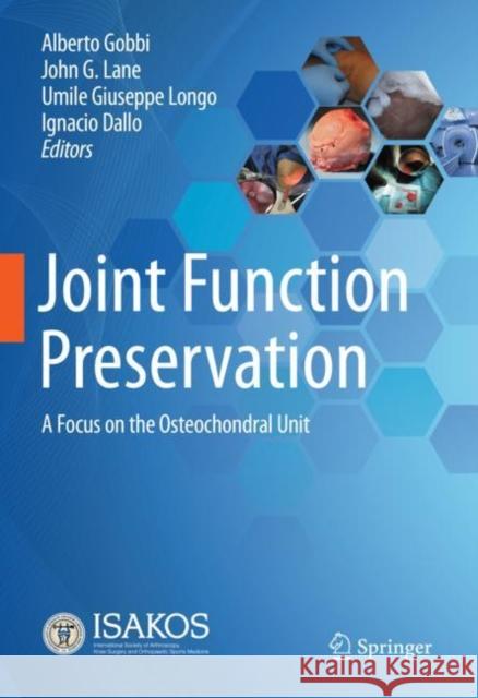 Joint Function Preservation: A Focus on the Osteochondral Unit Alberto Gobbi John Lane Umile Giuseppe Longo 9783030829575 Springer