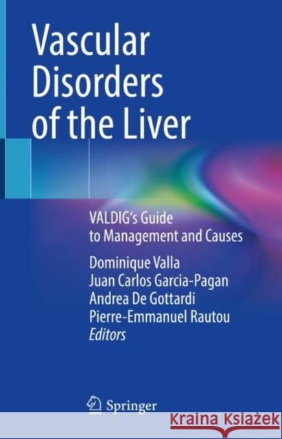 Vascular Disorders of the Liver: Valdig's Guide to Management and Causes Dominique Valla Juan Carlos Garcia-Pagan Andrea d 9783030829872 Springer