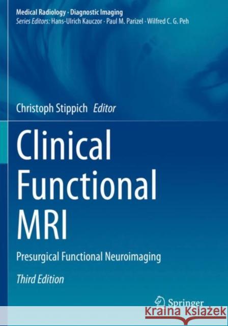 Clinical Functional MRI: Presurgical Functional Neuroimaging Christoph Stippich 9783030833459 Springer