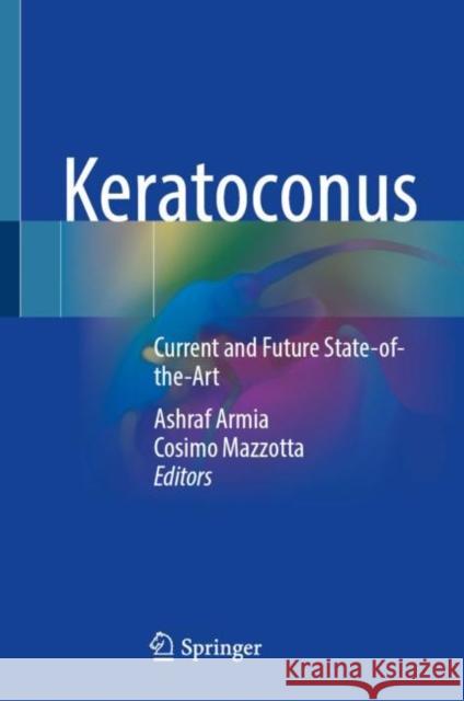 Keratoconus: Current and Future State-Of-The-Art Ashraf Armia Cosimo Mazzotta 9783030845056