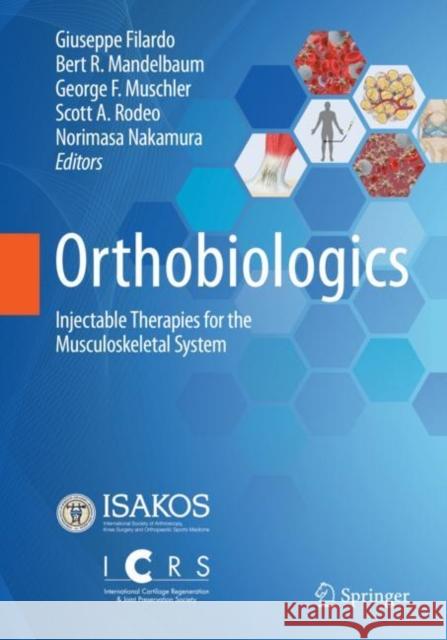 Orthobiologics: Injectable Therapies for the Musculoskeletal System Filardo, Giuseppe 9783030847432 Springer