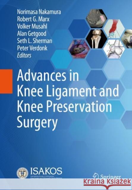 Advances in Knee Ligament and Knee Preservation Surgery Robert G. Marx Norimasa Nakamura Volker Musahl 9783030847470