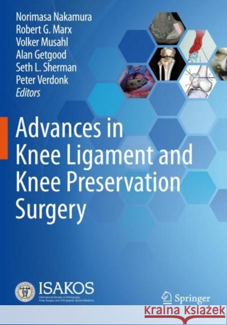 Advances in Knee Ligament and Knee Preservation Surgery Norimasa Nakamura Robert G. Marx Volker Musahl 9783030847500 Springer